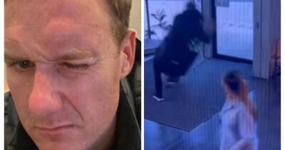Strictly's Dan Walker rushed to hospital for brain scan after running into glass door