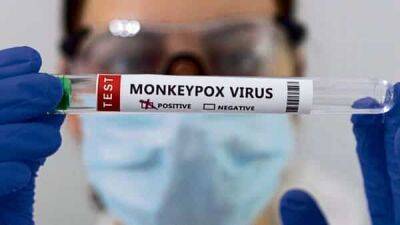 NIV Pune isolates first virus strain of monkeypox